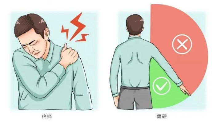 （挂网稿）针刀镜简讯245.png