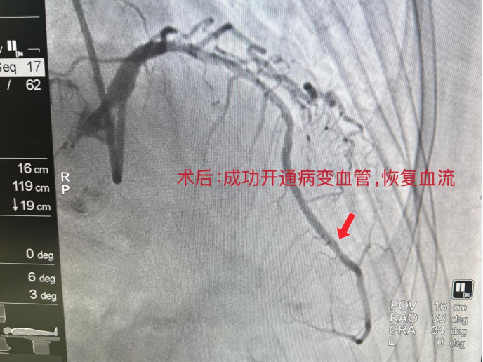 (挂网稿)年味里的坚守|他们放弃团聚,为 83 岁老人打通 “生命通路” (1)615.png (挂网稿)年味里的坚守|他们放弃团聚,为 83 岁老人打通 “生命通路” (1)615.png