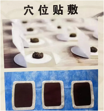 (挂网稿)绝境逢生!成功救治罕见双原发肺癌合并重度骨髓抑制患者901.png (挂网稿)绝境逢生!成功救治罕见双原发肺癌合并重度骨髓抑制患者901.png