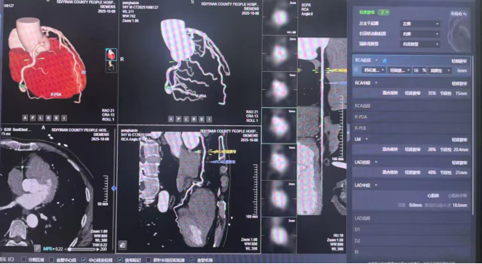 （挂网稿）别让“隐形危机”夺走健康！冠脉 CTA+AI筛查，揪出冠心病早期隐患878.png